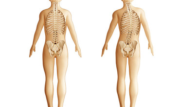 Spinal Deformities