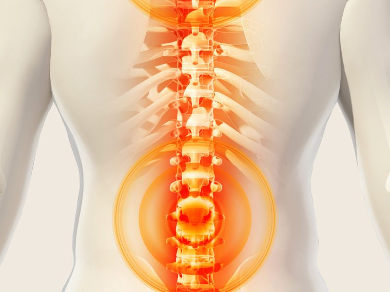Spinal Fractures